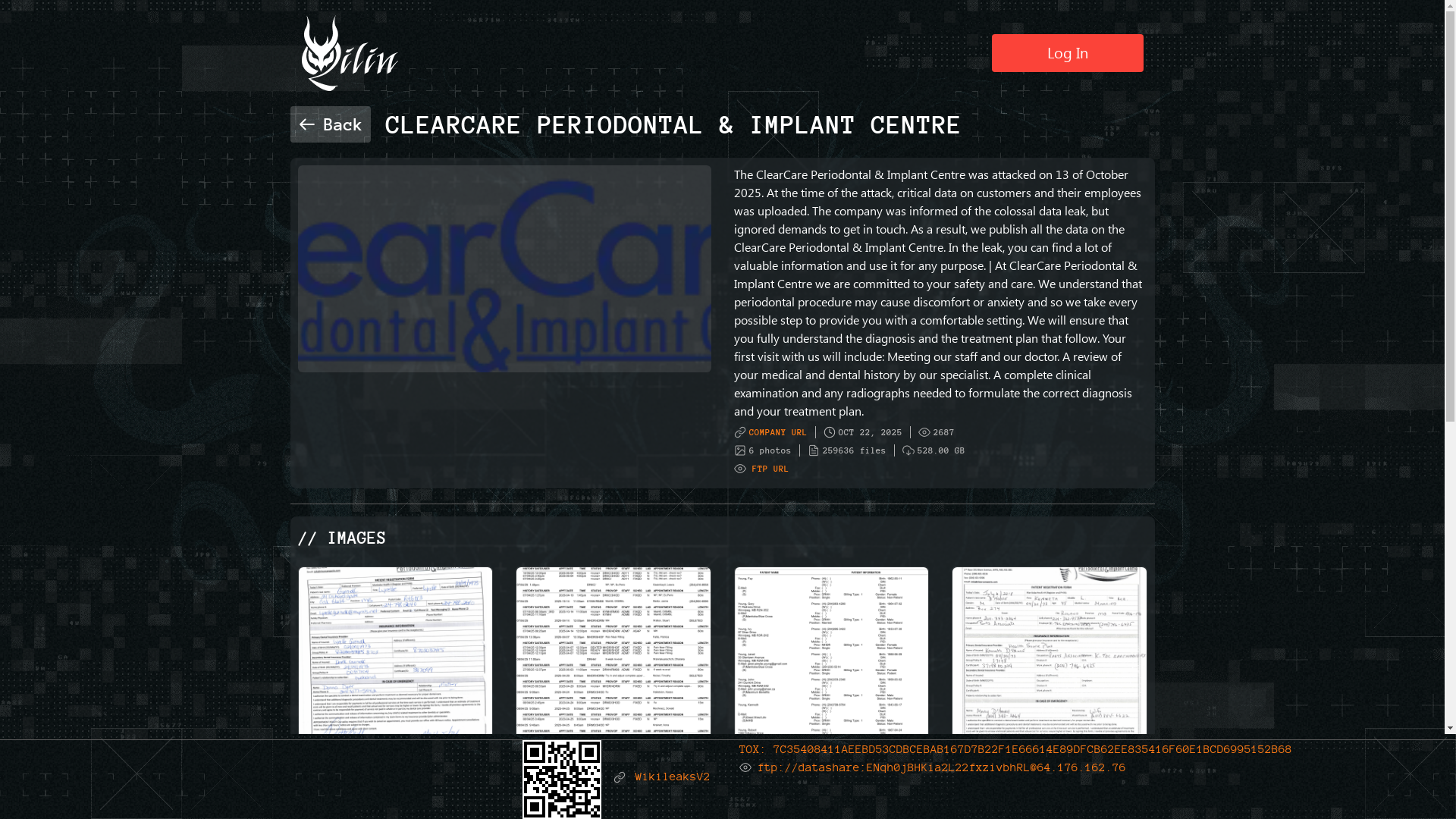 Screenshot del ataque